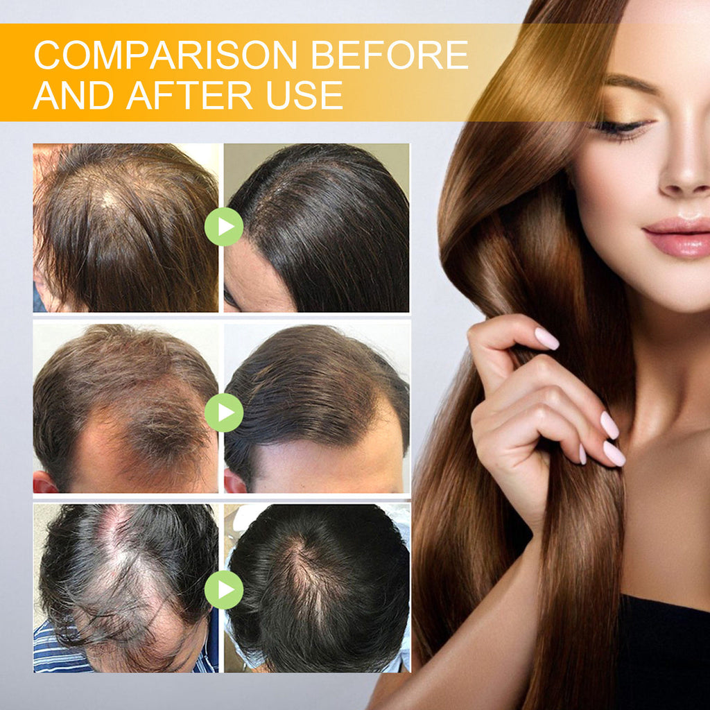 Biotin Hair Growth Serum Spray, Thickening Herbal Serum with Ginger Root Oil