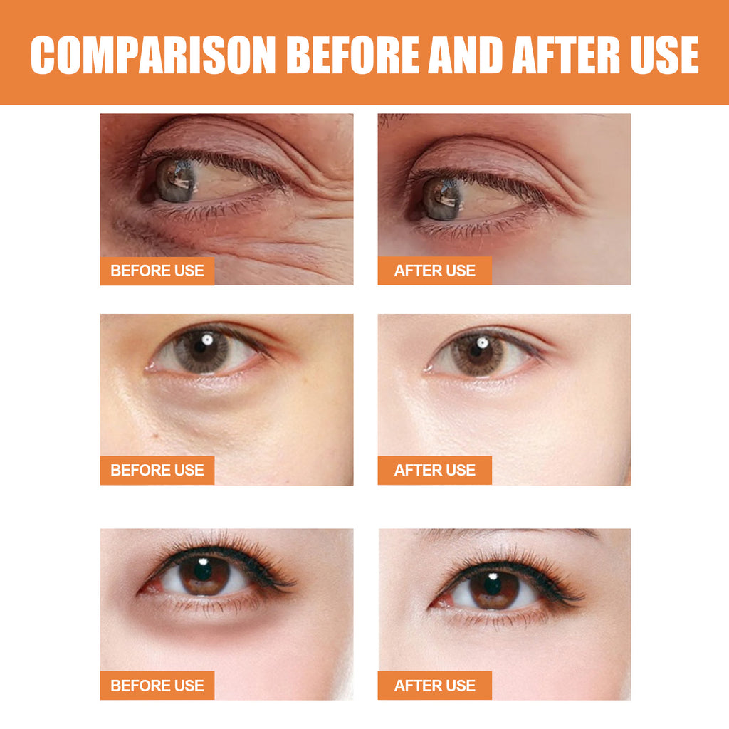 Revive Glow Vitamin C Eye Balm, Hydrating Eye Cream, Glow Eye Balm Stick, Brightening and Reducing Dark Circle, Reduces Puffiness