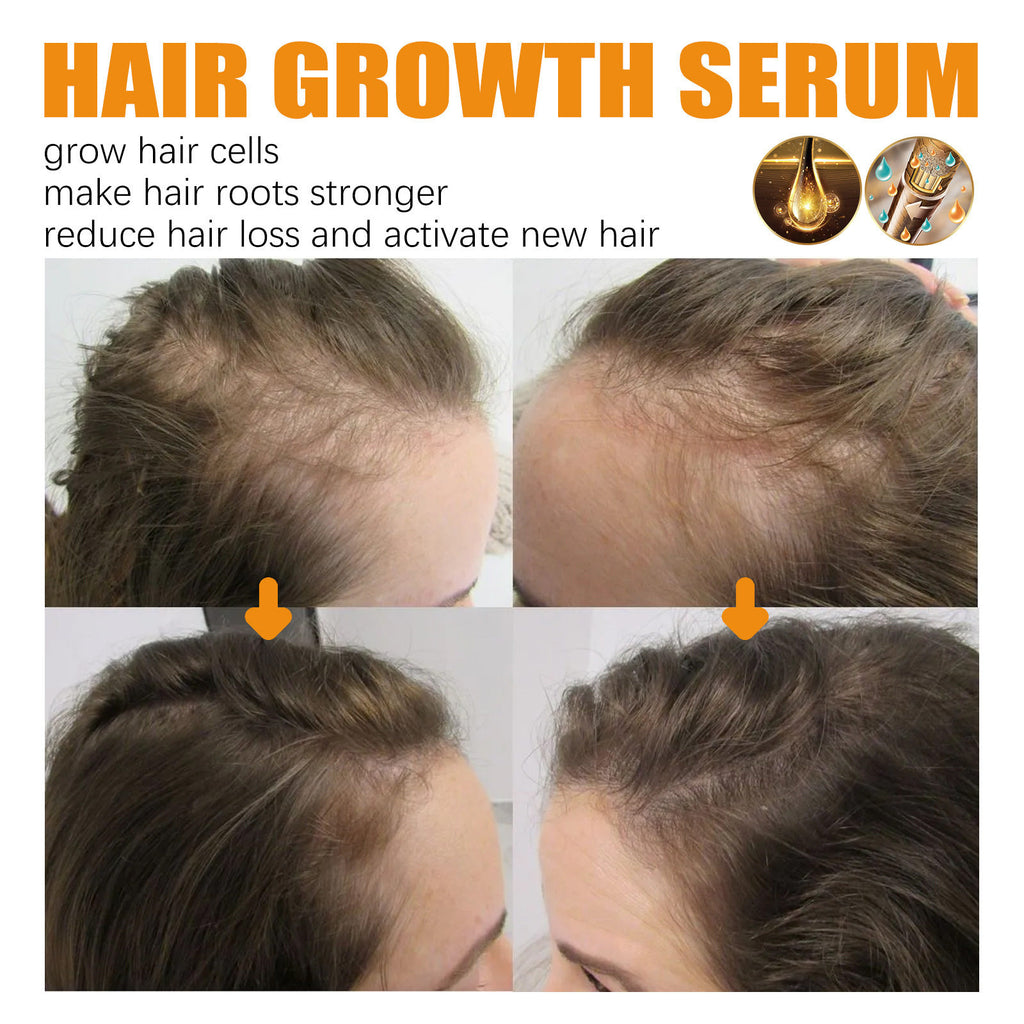 Biotin Hair Growth Serum Spray, Thickening Herbal Serum with Ginger Root Oil